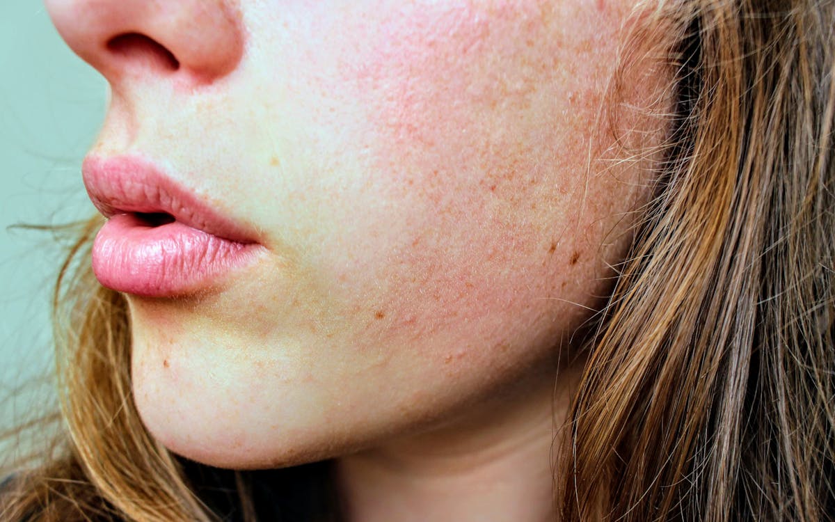 Lip Balm with SPF 15