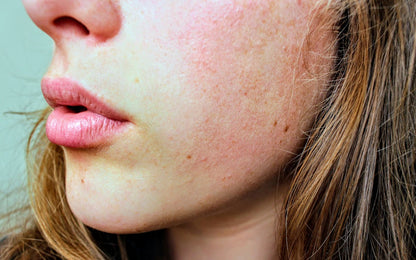 Lip Balm with SPF 15